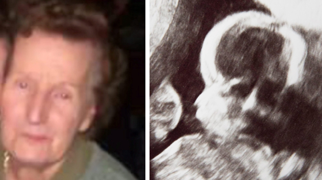 Debbie voit apparaître le visage de sa grand-mère morte sur l'échographie de son bébé (photos)